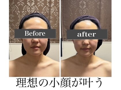 小顔アンドエイジングケア専門店 ビゼ(美sser)の写真