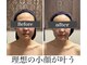 小顔アンドエイジングケア専門店 ビゼ(美sser)の写真