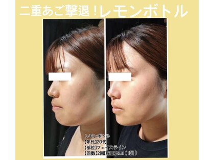 リファイン(REFINE)の写真