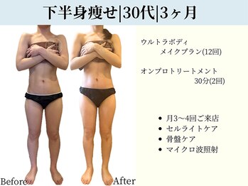 京都フォーエイチ(京都4H)/下半身痩せ|30代|3ヶ月
