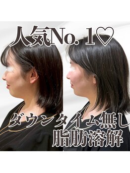 ミタメ 銀座店(MITAME)/気になるあご下のお肉に