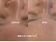 イイプラス(ii+)の写真/【毛穴悩みに☆】詰まり・開きの目立たない滑らか素肌に自信を◎