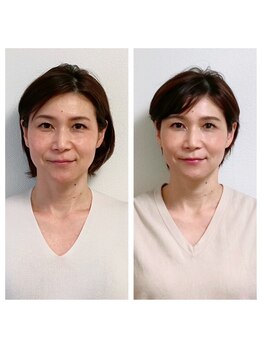 マナレア(Manalea)/アラフィフ世代の美肌改善も！