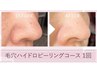 【初回限定】鼻の黒ずみ毛穴詰まりスッキリ&角質ケアで“つるん肌”体験