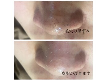 メンズプシュケ(men's PSYCHE)/毛穴洗浄