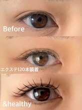 ブルーム(bloom)/&healthy