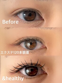 ブルーム(bloom)/&healthy