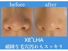 パールホワイトニングサロン 平塚店/韓国美容！最新セラピール