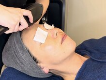 アイシス(AIsis)/光フェイシャル