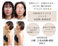 グロウ バイ フェイシャルデザイン アンド アイ(GROW)