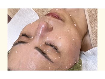 メルシー サロン(Merci Salon)/セルマン艶玉肌/不要な角質排除