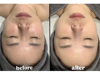 レブロン(LeBron)/大人気BBLフェイシャル