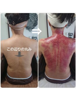 オアシス(OASIS)/ホット★カッサ