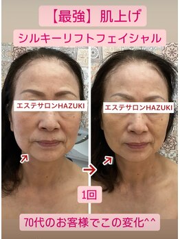 ハズキ(HAZUKI)/70代薄い敏感肌からハリつや肌