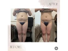 フォルチェ ゆめタウン広島店(Folche)/サイズダウン！