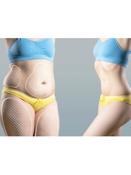 短期集中コースのあるサロン