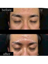 ユー 千葉駅前店(you)/メンズ眉毛/メンズ眉/千葉駅