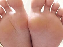 クランベリーネイル(cranberry nail)