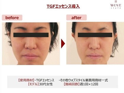 ブリエの写真