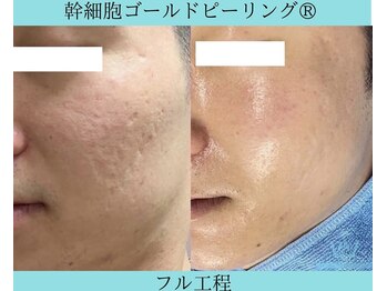 リメイククリニカルビューティー(Remake clinical beauty)/