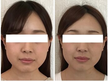 美容整体ウェリナ 名駅院/小顔矯正/骨盤矯正/美脚サロン