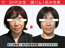 那賀洋子式 顔ジム 大分戸次店/30代女性顔ジム1回の効果