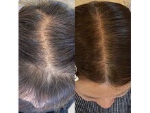 エミリエボーテの雰囲気（＜大人女子から大人気＞幹細胞ケアで気になる頭皮悩みを解決！）