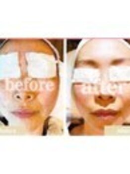 ビソウ(Biso)/光フォト