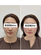 ハリサロンドオフ 堺東店(hari salon de off)/お客様のbefore→after