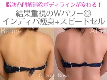 オリエンタルローザ 表参道(Oriental Rosa)/インディバ痩身＋スピードセル◎