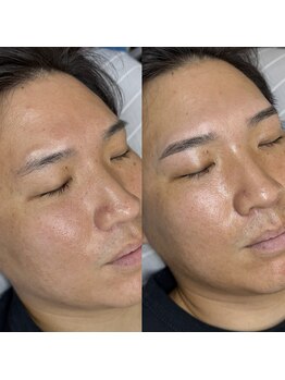 ジュビリー(JuBilee)/部分眉毛パーマ