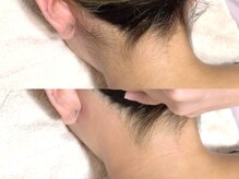 シーアットシュシュ(C at Chouchou)/うなじWax脱毛