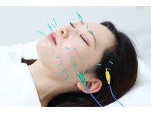 ライフサロン 天神(Life Salon)/パルス鍼で小顔効果UP！