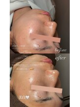 シュシュ(chouchou)/くすみ撃退