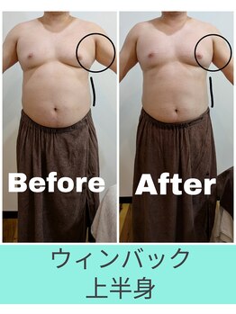 エミナル(EMINAL)/60分のウィンバック効果 脇お腹