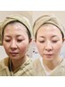 最高峰のHARI先端美容【VOS】気になる年齢肌・透明感が欲しい方に☆　¥16500