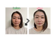 癒しサロン ななの音【肩こり/ヘッドスパ/自律神経調整/エステ/痩身】/フェイシャルエステ