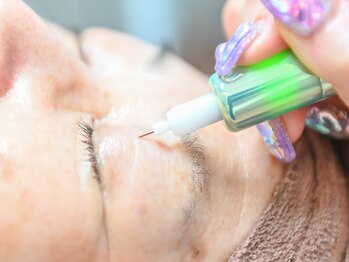 サロンファーストタッチ(Salon First Touch)の写真/【本気のシミケア】年齢とともに気になるお悩みにアプローチ！隠さないメイクで10年前の素肌感を◎