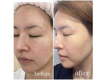 みなみ整骨院の雰囲気（LA発！大人気の結果重視のトリートメント。あらゆる悩みを解決）
