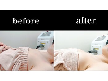 KMB 中崎町店/バストケア　美乳