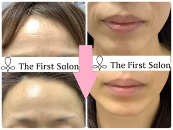 ザ ファーストサロン(The First Salon)/たるみ改善フルコース