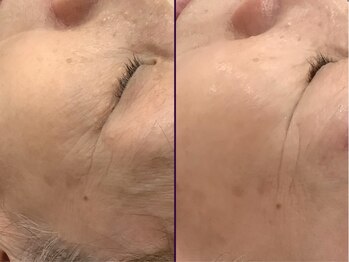 リシア(RECIA)/70代女性 サロンケア月2回