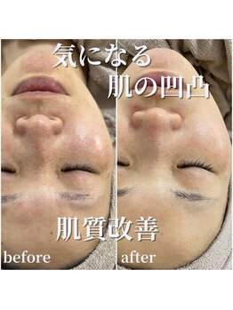 セリー(Celie)/お客様症例