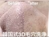 【お客様満足度No. 1】韓国式3D毛穴洗浄２回施術《男女同額》¥19800→15800