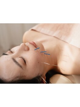 鍼灸施術を受けたい