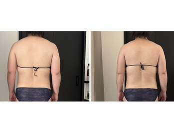 エミニナル(emininal)/痩身メニューモニター様