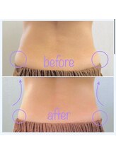 フェアリー/ボディ痩身 お腹 くびれ