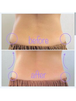 フェアリー/ボディ痩身 お腹 くびれ