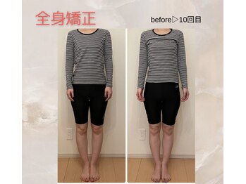 プルーム 大橋店(plume)/10回来店30代女性/肩こり腰痛O脚