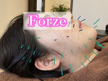 フォーゼ鍼灸整骨院/美容鍼☆ほうれい線を浅くする